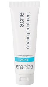 acne clearing treatment